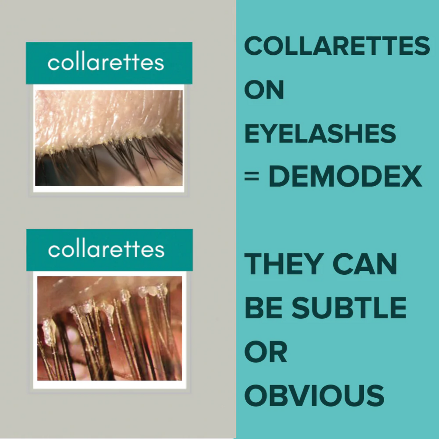 Demodex Mites Debris Cleansing System (+ free cosmetic bag) Regular price